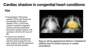 Comprehensive Interpretation of Cardiac Shadow on Chest X-Ray | PDF