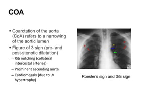 Comprehensive Interpretation of Cardiac Shadow on Chest X-Ray | PDF
