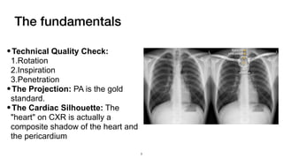 Comprehensive Interpretation of Cardiac Shadow on Chest X-Ray | PDF