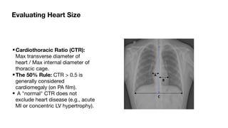 Comprehensive Interpretation of Cardiac Shadow on Chest X-Ray | PDF