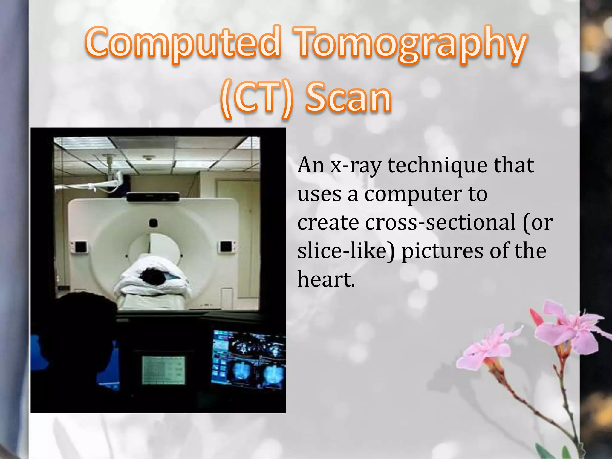 An x-ray technique that
uses a computer to
create cross-sectional (or
slice-like) pictures of the
heart.

 