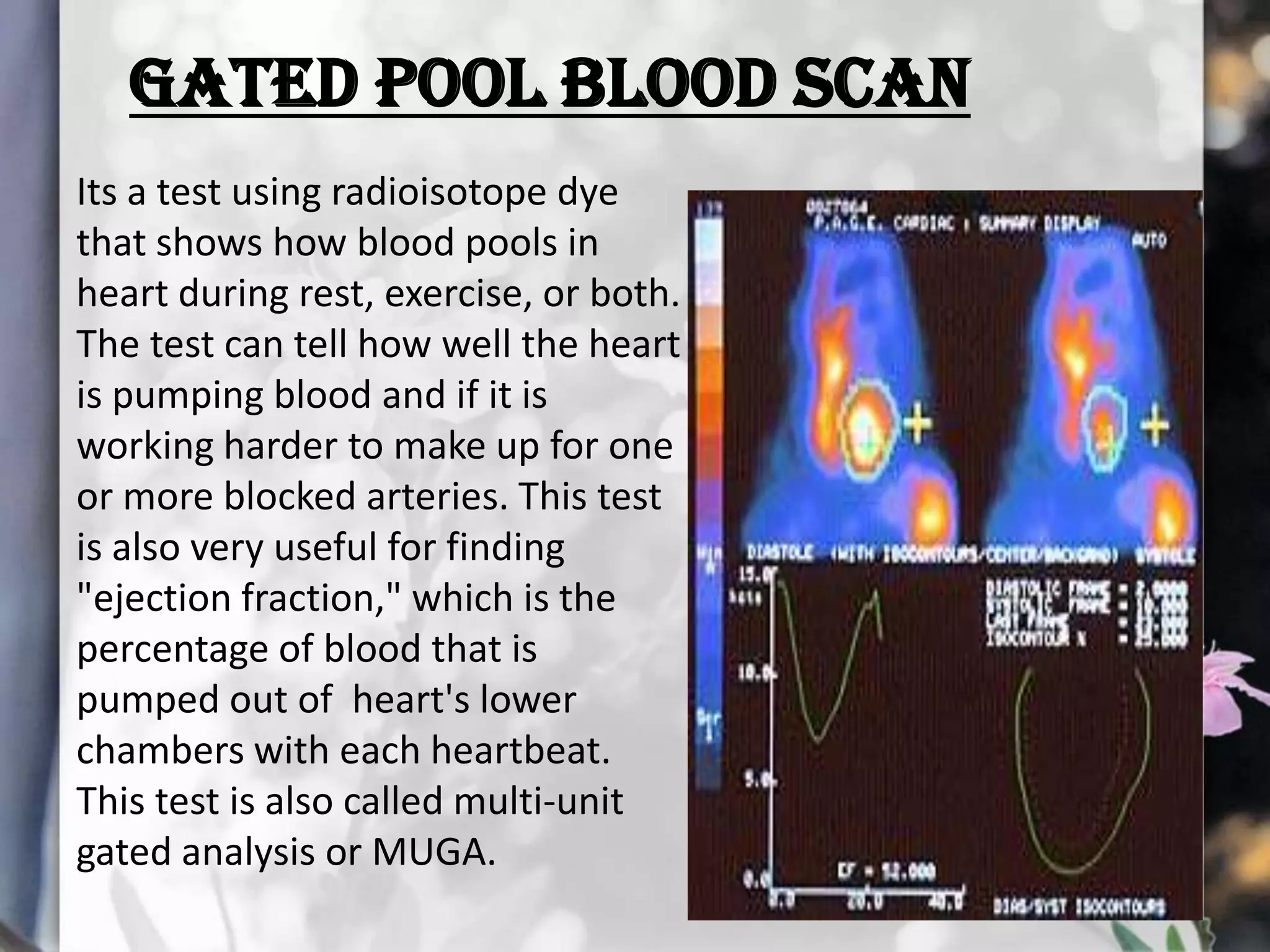 GATED POOL BLOOD SCAN
Its a test using radioisotope dye
that shows how blood pools in
heart during rest, exercise, or both.
The test can tell how well the heart
is pumping blood and if it is
working harder to make up for one
or more blocked arteries. This test
is also very useful for finding
"ejection fraction," which is the
percentage of blood that is
pumped out of heart's lower
chambers with each heartbeat.
This test is also called multi-unit
gated analysis or MUGA.

 