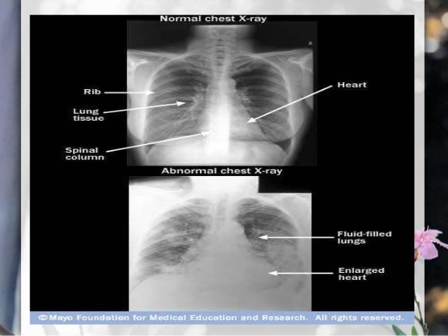 test dye heart with injection of diagnostic system procedures cardiovascular