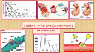 Cardiac Profile Tests(Biochemical )
DR ROHINI C SANE
 