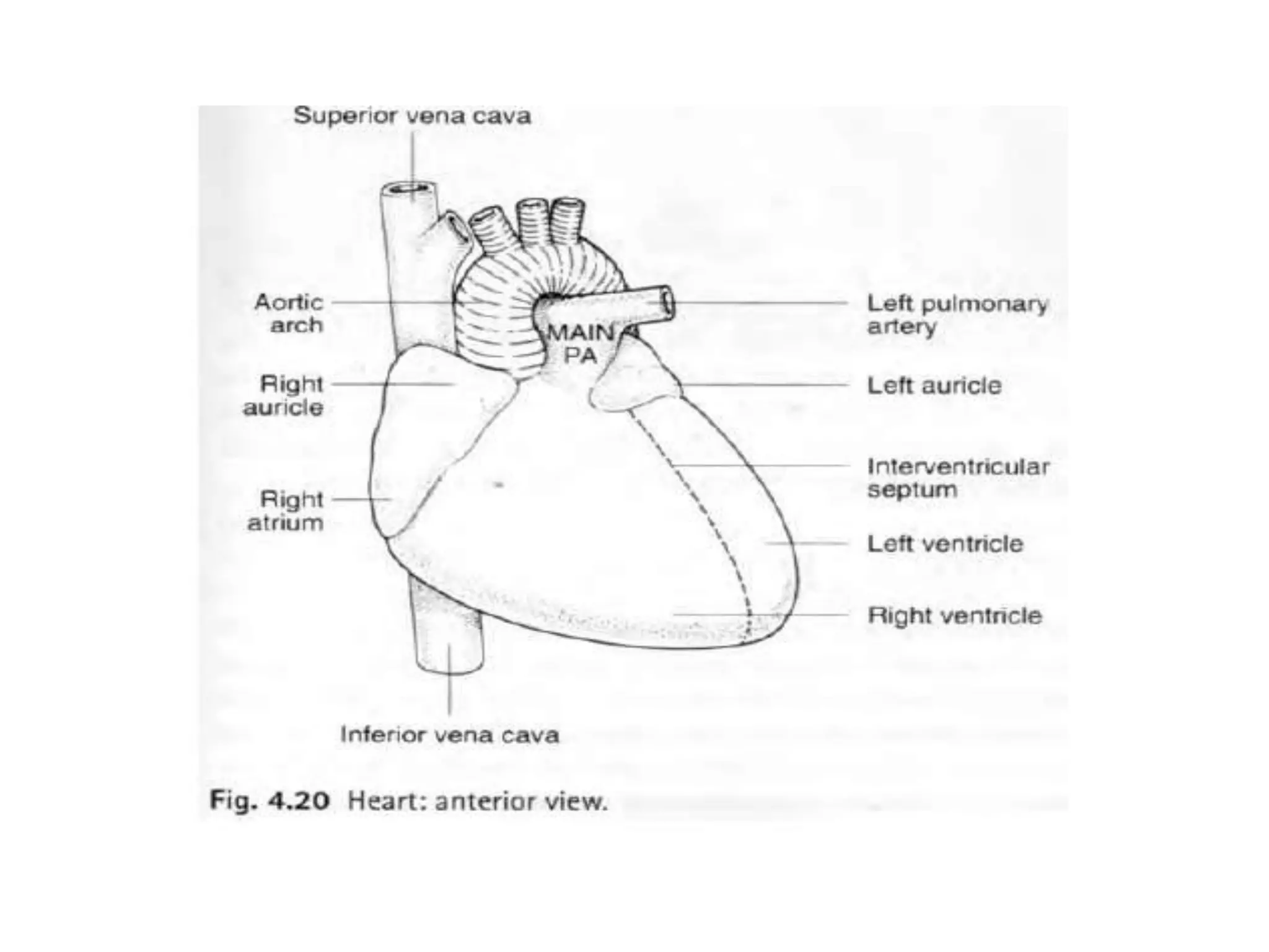 Radiographic approach to cardiac enlargement | PPTX