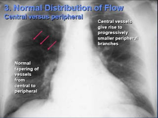 Radiographic approach to cardiac enlargement | PPTX
