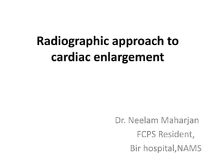 Radiographic approach to
cardiac enlargement
Dr. Neelam Maharjan
FCPS Resident,
Bir hospital,NAMS
 