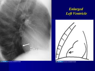 Cardiac radiology | PPT