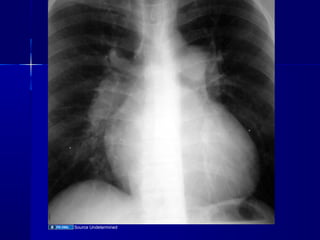 Cardiac radiology | PPT
