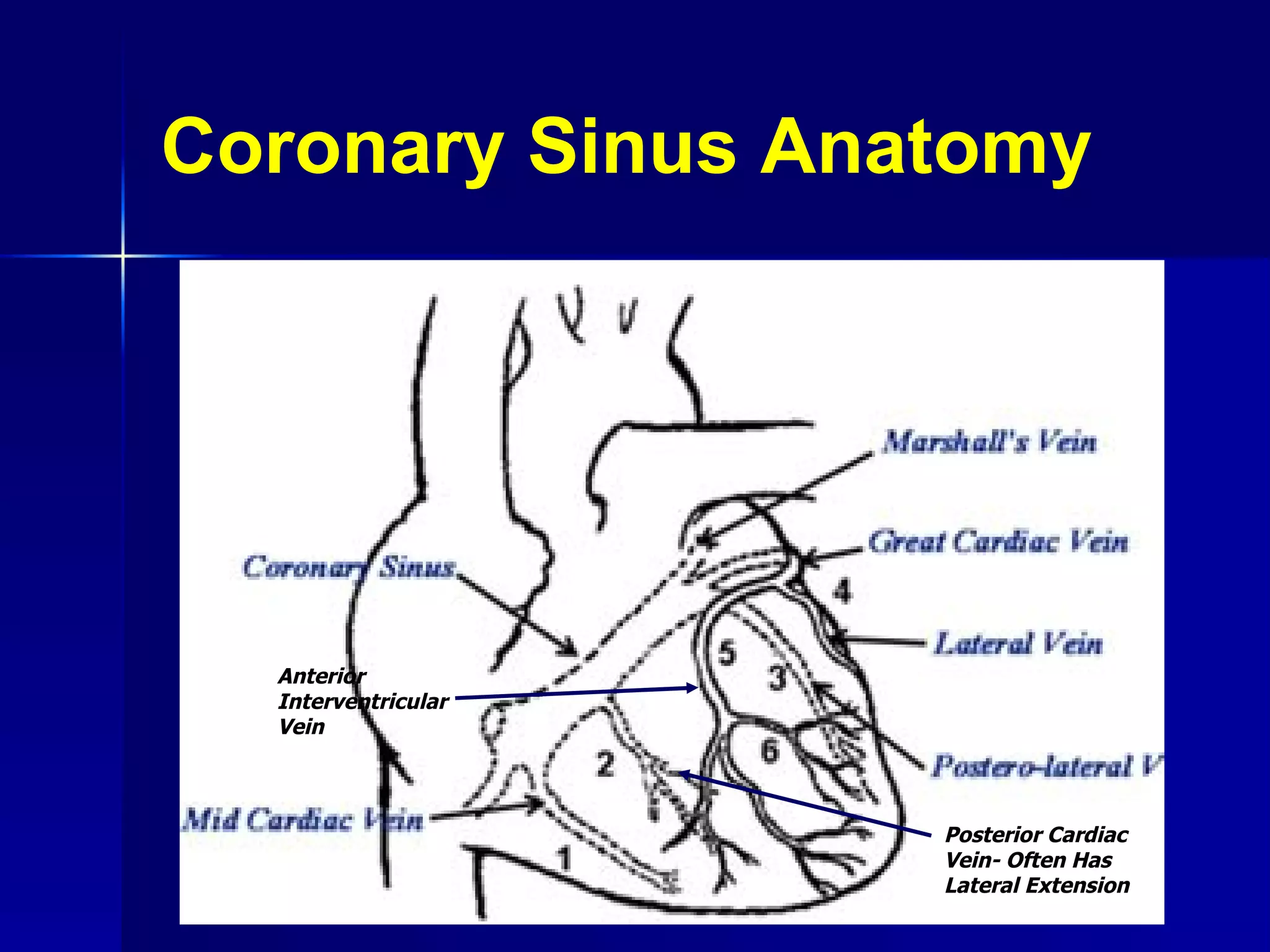 Coronary Sinus Anatomy Anterior Interventricular Vein Posterior Cardiac Vein- Often Has Lateral Extension 