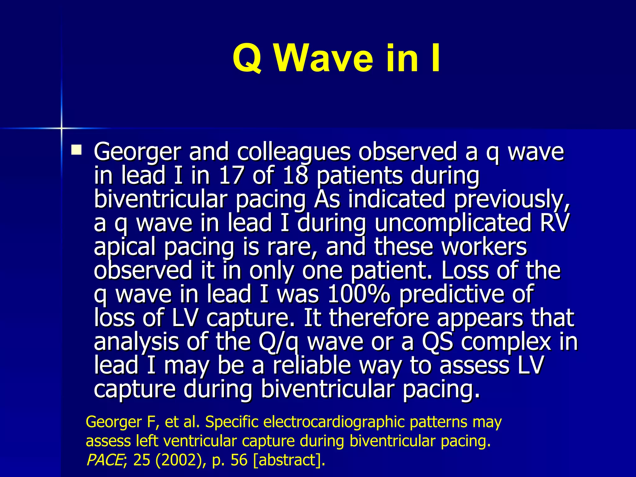 Q Wave in I Georger and colleagues observed a q wave in lead I in 17 of 18 patients during biventricular pacing As indicated previously, a q wave in lead I during uncomplicated RV apical pacing is rare, and these workers observed it in only one patient. Loss of the q wave in lead I was 100% predictive of loss of LV capture. It therefore appears that analysis of the Q/q wave or a QS complex in lead I may be a reliable way to assess LV capture during biventricular pacing.  Georger F, et al. Specific electrocardiographic patterns may assess left ventricular capture during biventricular pacing.  PACE ; 25   (2002), p. 56 [abstract].   