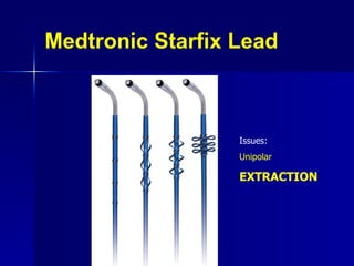 Medtronic Starfix Lead Issues: Unipolar EXTRACTION 
