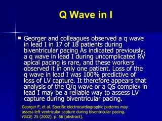 Q Wave in I Georger and colleagues observed a q wave in lead I in 17 of 18 patients during biventricular pacing As indicated previously, a q wave in lead I during uncomplicated RV apical pacing is rare, and these workers observed it in only one patient. Loss of the q wave in lead I was 100% predictive of loss of LV capture. It therefore appears that analysis of the Q/q wave or a QS complex in lead I may be a reliable way to assess LV capture during biventricular pacing.  Georger F, et al. Specific electrocardiographic patterns may assess left ventricular capture during biventricular pacing.  PACE ; 25   (2002), p. 56 [abstract].   