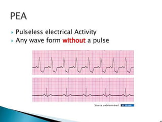 Cardiac rhythm disorders