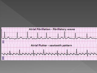 Cardiac rhythm disorders