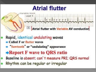 Cardiac rhythm disorders