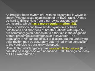 Cardiac rhythm disorders