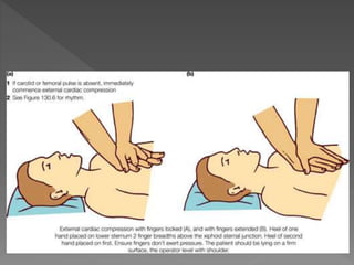 Cardiac rhythm disorders