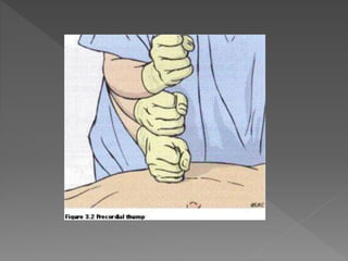 Cardiac rhythm disorders