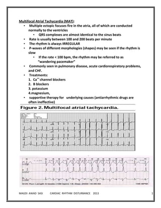 MAGDI AWAD SASI CARDIAC RHYTHM DISTURBANCE 2013 16
Multifocal Atrial Tachycardia (MAT):
• Multiple ectopic focuses fire in the atria, all of which are conducted
normally to the ventricles
• QRS complexes are almost identical to the sinus beats
• Rate is usually between 100 and 200 beats per minute
• The rhythm is always IRREGULAR
• P-waves of different morphologies (shapes) may be seen if the rhythm is
slow
• If the rate < 100 bpm, the rhythm may be referred to as
“wandering pacemaker”
• Commonly seen in pulmonary disease, acute cardiorespiratory problems,
and CHF.
• Treatments:
1. Ca++
channel blockers
2. B blockers
3. potassium
4.magnesium,
• supportive therapy for underlying causes (antiarrhythmic drugs are
often ineffective)
 