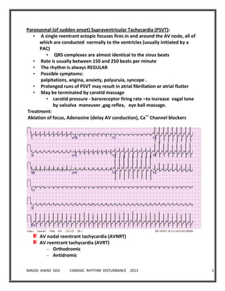 MAGDI AWAD SASI CARDIAC RHYTHM DISTURBANCE 2013 18
Paroxysmal (of sudden onset) Supraventricular Tachycardia (PSVT):
• A single reentrant ectopic focuses fires in and around the AV node, all of
which are conducted normally to the ventricles (usually initiated by a
PAC)
• QRS complexes are almost identical to the sinus beats
• Rate is usually between 150 and 250 beats per minute
• The rhythm is always REGULAR
• Possible symptoms:
palpitations, angina, anxiety, polyuruia, syncope .
• Prolonged runs of PSVT may result in atrial fibrillation or atrial flutter
• May be terminated by carotid massage
• carotid pressure - baroreceptor firing rate –to increase vagal tone
by valsalva maneuver ,gag reflex, eye ball massage.
Treatment:
Ablation of focus, Adenosine (delay AV conduction), Ca++
Channel blockers
AV nodal reentrant tachycardia (AVNRT)
AV reentrant tachycardia (AVRT)
– Orthodromic
– Antidromic
 