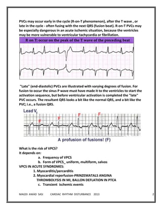 MAGDI AWAD SASI CARDIAC RHYTHM DISTURBANCE 2013 21
PVCs may occur early in the cycle (R-on-T phenomenon), after the T wave , or
late in the cycle - often fusing with the next QRS (fusion beat). R-on-T PVCs may
be especially dangerous in an acute ischemic situation, because the ventricles
may be more vulnerable to ventricular tachycardia or fibrillation.
"Late" (end-diastolic) PVCs are illustrated with varying degrees of fusion. For
fusion to occur the sinus P wave must have made it to the ventricles to start the
activation sequence, but before ventricular activation is completed the "late"
PVC occurs. The resultant QRS looks a bit like the normal QRS, and a bit like the
PVC; i.e., a fusion QRS.
What is the risk of VPCS?
It depends on:
a. Frequency of VPCS
b. Form of VPCS_ uniform, multiform, salvos
VPCS IN ACUTE SYNDROMES:
1. Myocarditis/percarditis
2. Myocardial reperfusion-PRINZEMATALS ANGINA
THROMBOLYSIS IN MI, BALLON DEFLATION IN PTCA
c. Transient ischemic events
 