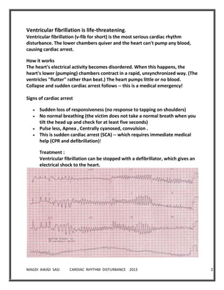 MAGDI AWAD SASI CARDIAC RHYTHM DISTURBANCE 2013 26
Ventricular fibrillation is life-threatening.
Ventricular fibrillation (v-fib for short) is the most serious cardiac rhythm
disturbance. The lower chambers quiver and the heart can't pump any blood,
causing cardiac arrest.
How it works
The heart's electrical activity becomes disordered. When this happens, the
heart's lower (pumping) chambers contract in a rapid, unsynchronized way. (The
ventricles "flutter" rather than beat.) The heart pumps little or no blood.
Collapse and sudden cardiac arrest follows -- this is a medical emergency!
Signs of cardiac arrest
Sudden loss of responsiveness (no response to tapping on shoulders)
No normal breathing (the victim does not take a normal breath when you
tilt the head up and check for at least five seconds)
Pulse less, Apnea , Centrally cyanosed, convulsion .
This is sudden cardiac arrest (SCA) -- which requires immediate medical
help (CPR and defibrillation)!
Treatment :
Ventricular fibrillation can be stopped with a defibrillator, which gives an
electrical shock to the heart.
 
