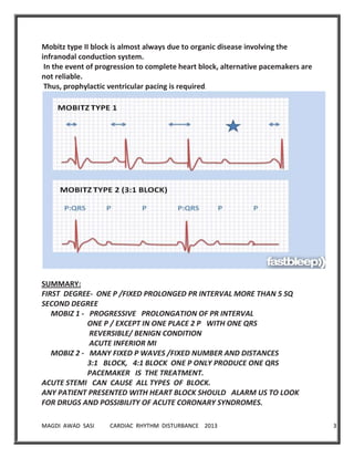 MAGDI AWAD SASI CARDIAC RHYTHM DISTURBANCE 2013 33
Mobitz type II block is almost always due to organic disease involving the
infranodal conduction system.
In the event of progression to complete heart block, alternative pacemakers are
not reliable.
Thus, prophylactic ventricular pacing is required.
SUMMARY:
FIRST DEGREE- ONE P /FIXED PROLONGED PR INTERVAL MORE THAN 5 SQ
SECOND DEGREE
MOBIZ 1 - PROGRESSIVE PROLONGATION OF PR INTERVAL
ONE P / EXCEPT IN ONE PLACE 2 P WITH ONE QRS
REVERSIBLE/ BENIGN CONDITION
ACUTE INFERIOR MI
MOBIZ 2 - MANY FIXED P WAVES /FIXED NUMBER AND DISTANCES
3:1 BLOCK, 4:1 BLOCK ONE P ONLY PRODUCE ONE QRS
PACEMAKER IS THE TREATMENT.
ACUTE STEMI CAN CAUSE ALL TYPES OF BLOCK.
ANY PATIENT PRESENTED WITH HEART BLOCK SHOULD ALARM US TO LOOK
FOR DRUGS AND POSSIBILITY OF ACUTE CORONARY SYNDROMES.
 