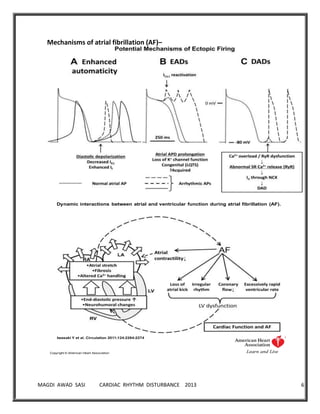 MAGDI AWAD SASI CARDIAC RHYTHM DISTURBANCE 2013 6
Mechanisms of atrial fibrillation (AF)–
Dynamic interactions between atrial and ventricular function during atrial fibrillation (AF).
Iwasaki Y et al. Circulation 2011;124:2264-2274
Copyright © American Heart Association
 