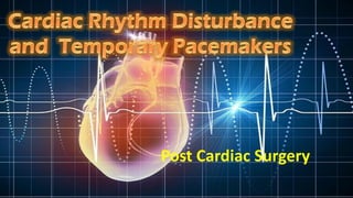 Post Cardiac Surgery
 