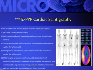 Pyp Scan Order Cardiac Scan in Amyloidosis. IE, HF-116 Slides.pptx