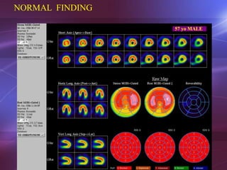 Cardiac scanning | PPT