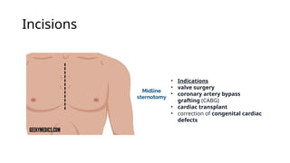 Cardiac surgery, open heart surgery.pptx