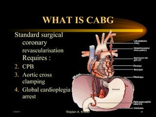 WHAT IS CABG Standard surgical coronary  revascularisation  Requires :  CPB Aortic cross clamping Global cardioplegia arrest 