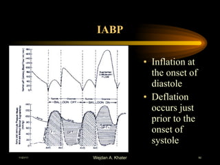 IABP Inflation at the onset of diastole  Deflation occurs just prior to the onset of systole 