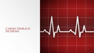 Cardiac surgery | PPTX