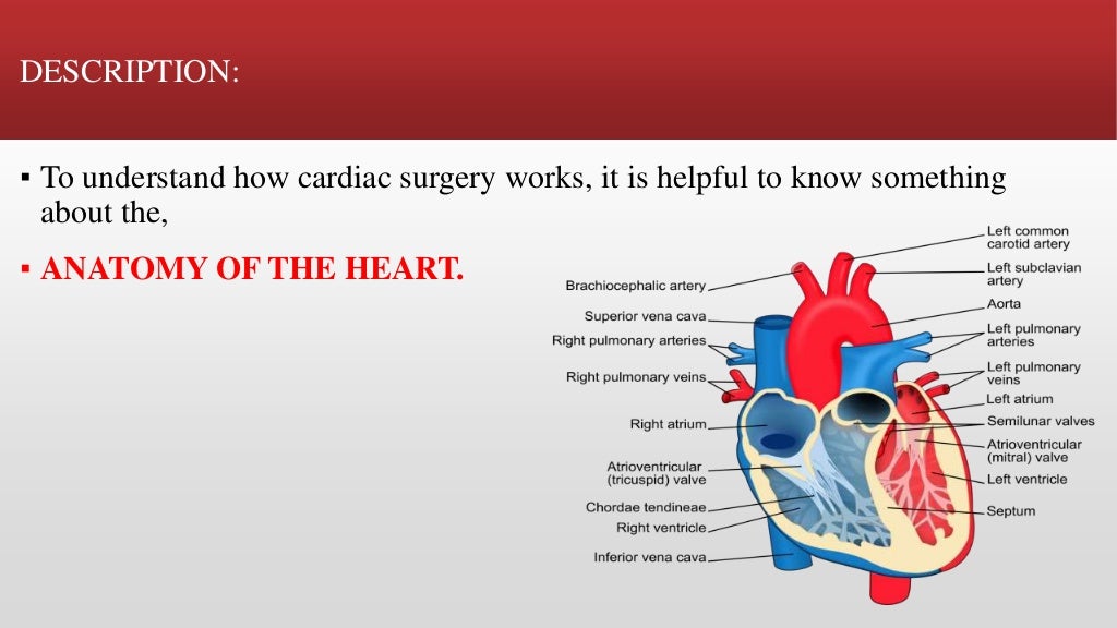 Cardiac surgery