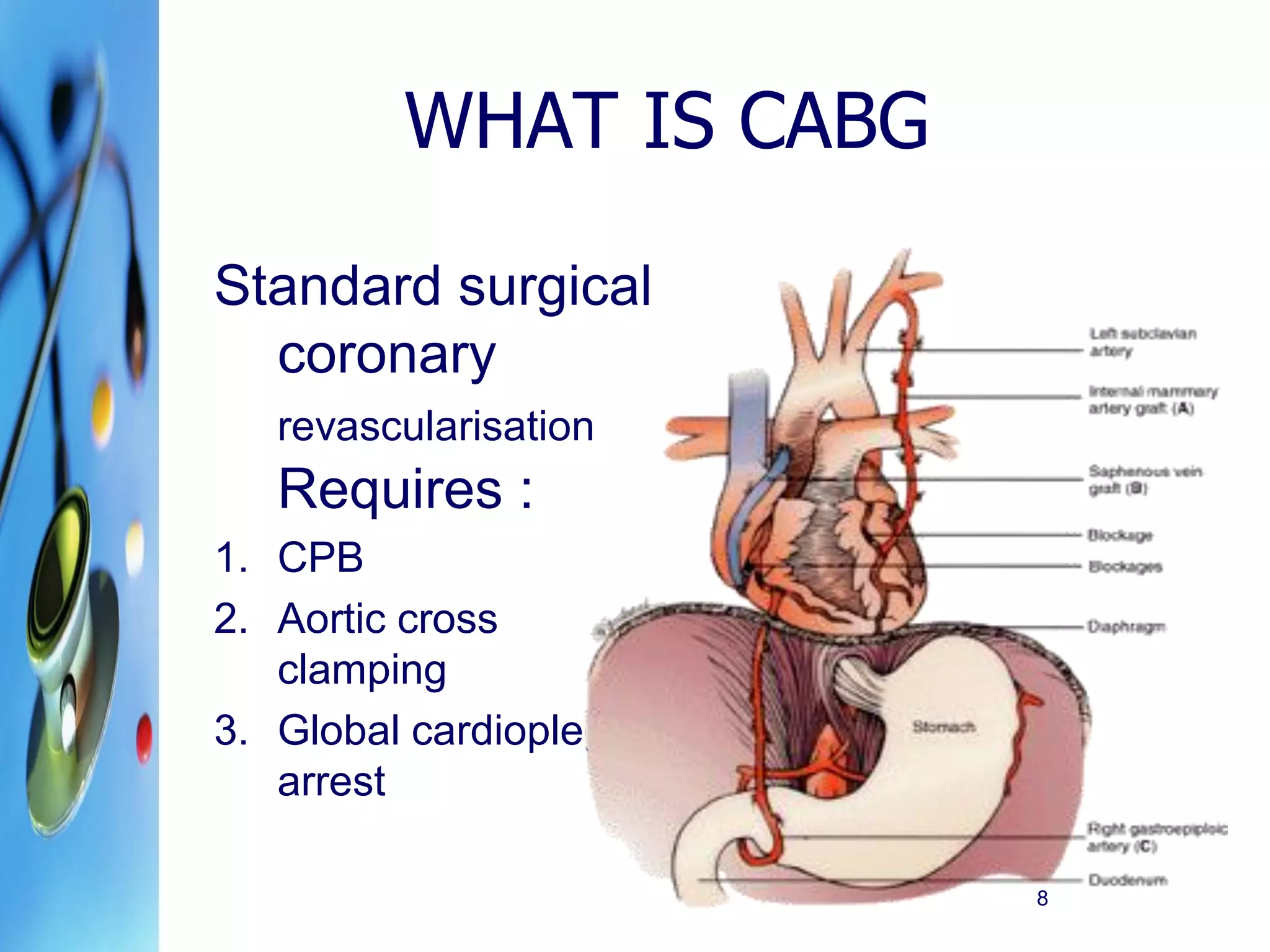 Cardiac Surgical Procedures PDF Cardiac Surgical Procedures PDF
