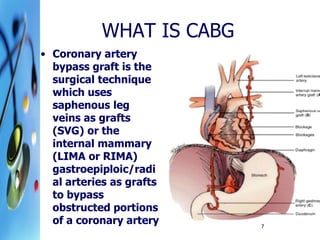 Lima Rima Svg Cardiac surgical procedures | PDF