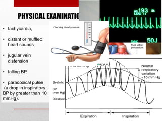PHYSICAL EXAMINATION
• tachycardia,

• distant or muffled
  heart sounds

• jugular vein
  distension

• falling BP,

• paradoxical pulse
 (a drop in inspiratory
BP by greater than 10
mmHg).
 