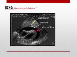 ECHO: “diagnostic test of choice “
 