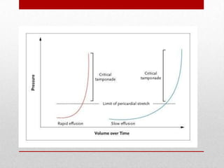 Pericardial Pressure-
Volume Relation
 