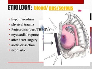 ETIOLOGY: blood/ pus/serous
•   hypothyroidism
•   physical trauma
•   Pericarditis (bact/TB/HIV)
•   myocardial rupture
•   after heart surgery
•   aortic dissection
•   neoplastic
 