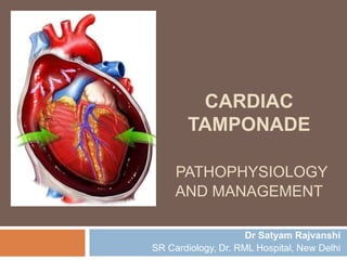 CARDIAC
TAMPONADE
PATHOPHYSIOLOGY
AND MANAGEMENT
Dr Satyam Rajvanshi
SR Cardiology, Dr. RML Hospital, New Delhi
 