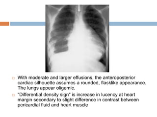  With moderate and larger effusions, the anteroposterior
cardiac silhouette assumes a rounded, flasklike appearance.
The lungs appear oligemic.
 "Differential density sign" is increase in lucency at heart
margin secondary to slight difference in contrast between
pericardial fluid and heart muscle
 