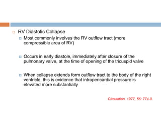  RV Diastolic Collapse
 Most commonly involves the RV outflow tract (more
compressible area of RV)
 Occurs in early diastole, immediately after closure of the
pulmonary valve, at the time of opening of the tricuspid valve
 When collapse extends form outflow tract to the body of the right
ventricle, this is evidence that intrapericardial pressure is
elevated more substantially
Circulation. 1977, 56: 774-9.
 