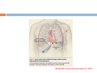 NEJM 349;7 www.nejm.org august 14, 2003
 