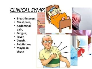 CLINICAL SYMPTOMS
• Breathlessness
• Chest pain,
• Abdominal
pain,
• Fatigue,
• Fever,
• Cough,
• Palpitation,
• Maybe in
shock
 