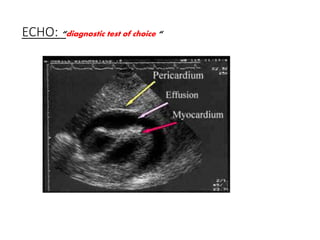 ECHO: “diagnostic test of choice “
 