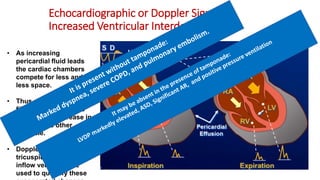 Interdependent Inflow Cardiac Tamponade.pdf
